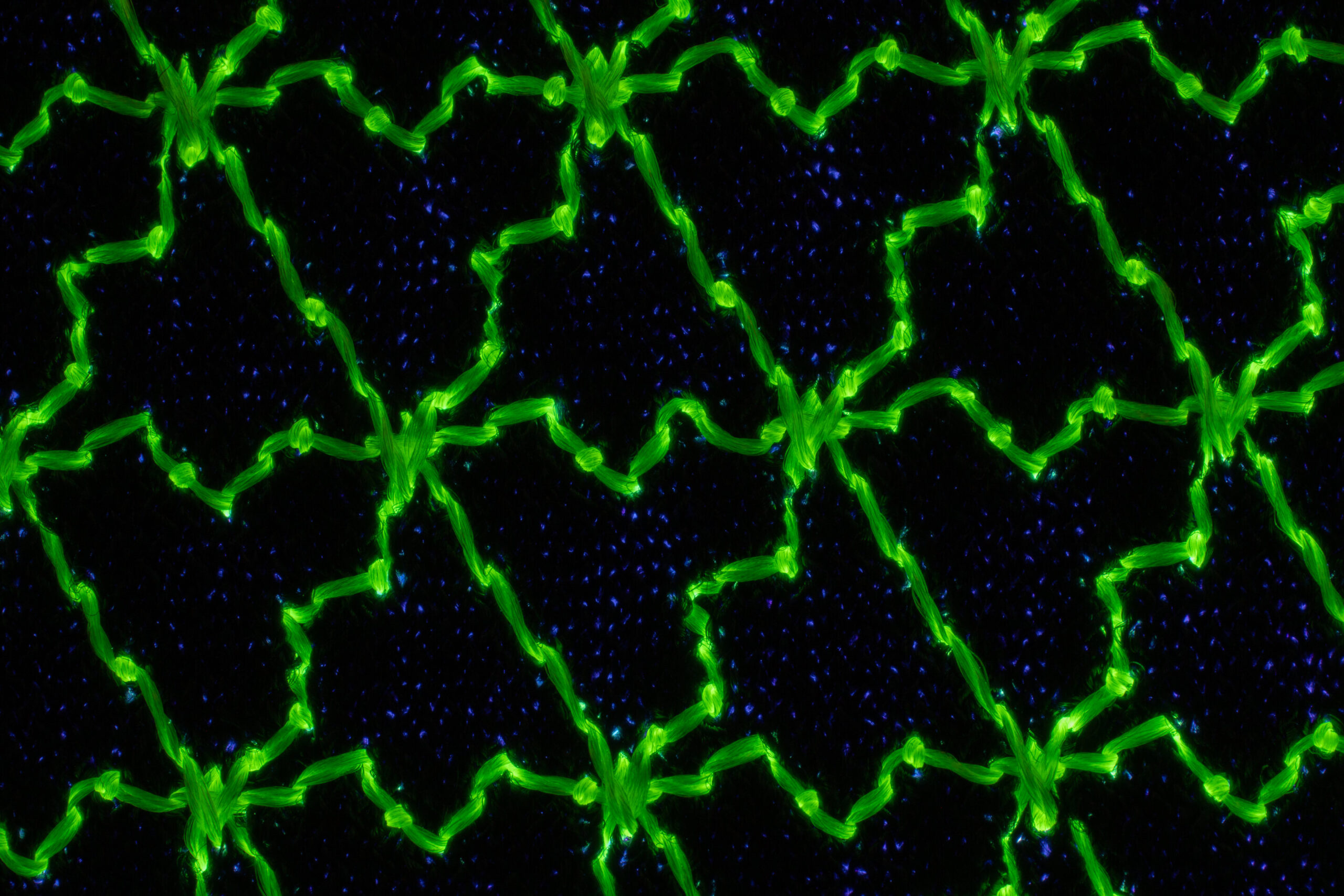 Machine Embroidery Encodes Skin-Like Tension Lines in Textiles, Enabling Mass-Customizable Wearables